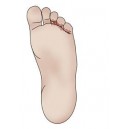 Athlete's Foot