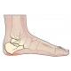 Heel Pain
