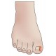 Ingrown Toenails