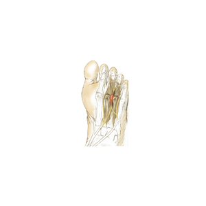 Conditions of the Foot
