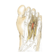 Conditions of the Foot